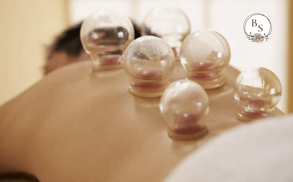 cupping therapy calgary